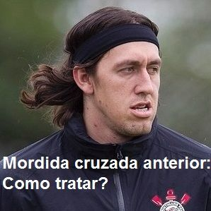 mordida cruzada anterior do goleiro cassio